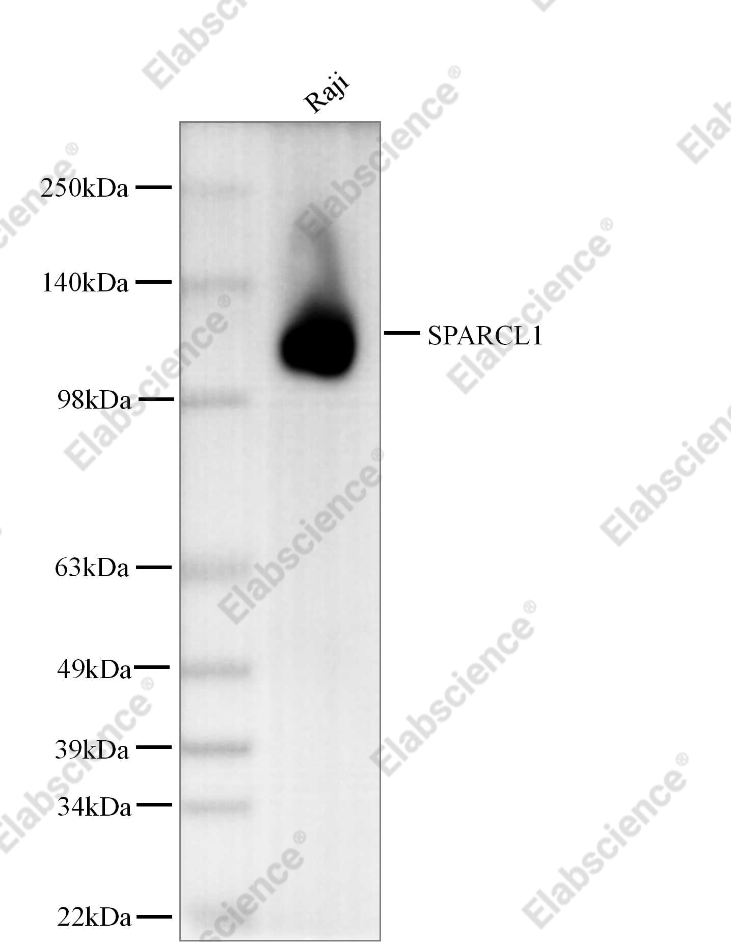 Recombinant SPARCL1/SPARC-like 1 Monoclonal Antibody - 1