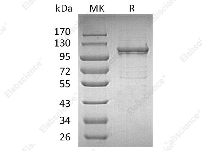 Recombinant Human IDE/Insulysin Protein (His Tag) - 1