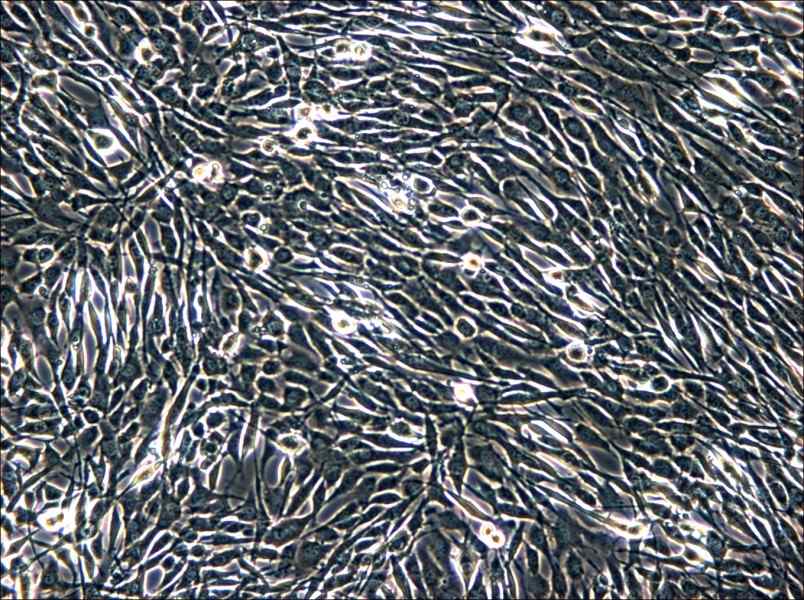 YUMM1.1 Cell Complete Medium - 5