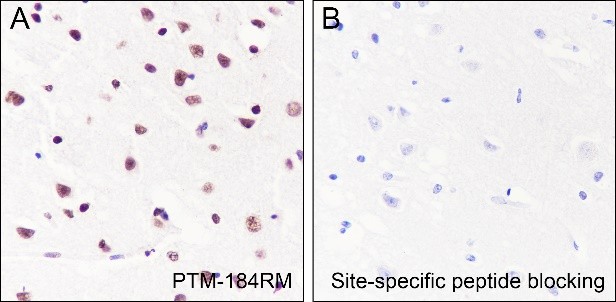 Recombinant Histone H3 (Acetyl Lys122) Monoclonal Antibody-searchlist-3