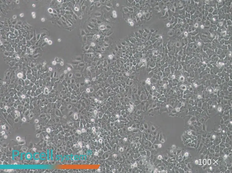 SACC-83 Cell Complete Medium - 2