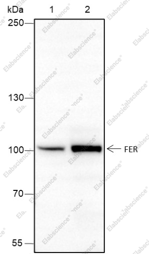 Recombinant FER Monoclonal Antibody - 1