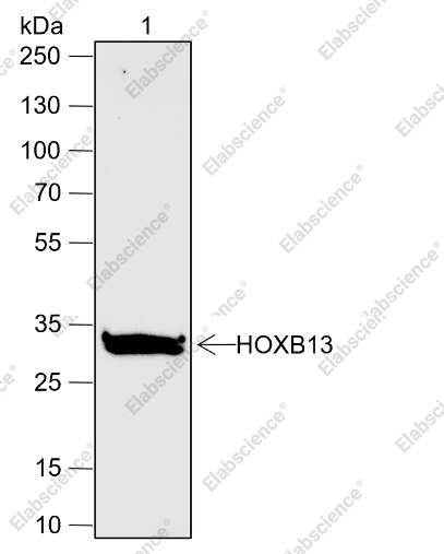 Recombinant HOXB13 Monoclonal Antibody - 1