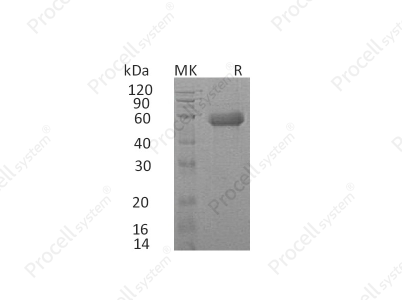 IL-18RAcP/IL-1R7 (C-6His), Human, Recombinant