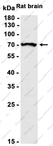 Recombinant S6K1 Monoclonal Antibody - 1