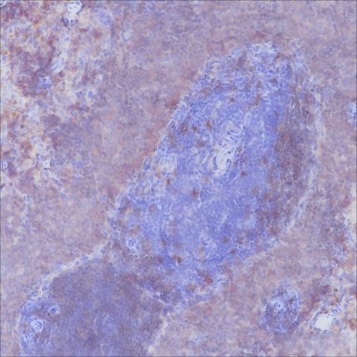 Recombinant CD20 Monoclonal Antibody - small - 4