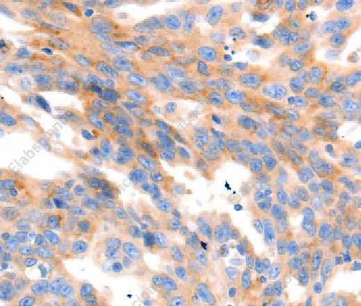 MAP2K2 Polyclonal Antibody - 3