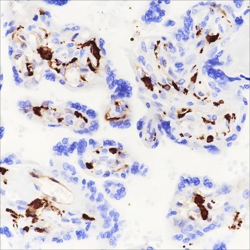 Recombinant Factor XIIIa Monoclonal Antibody - 2