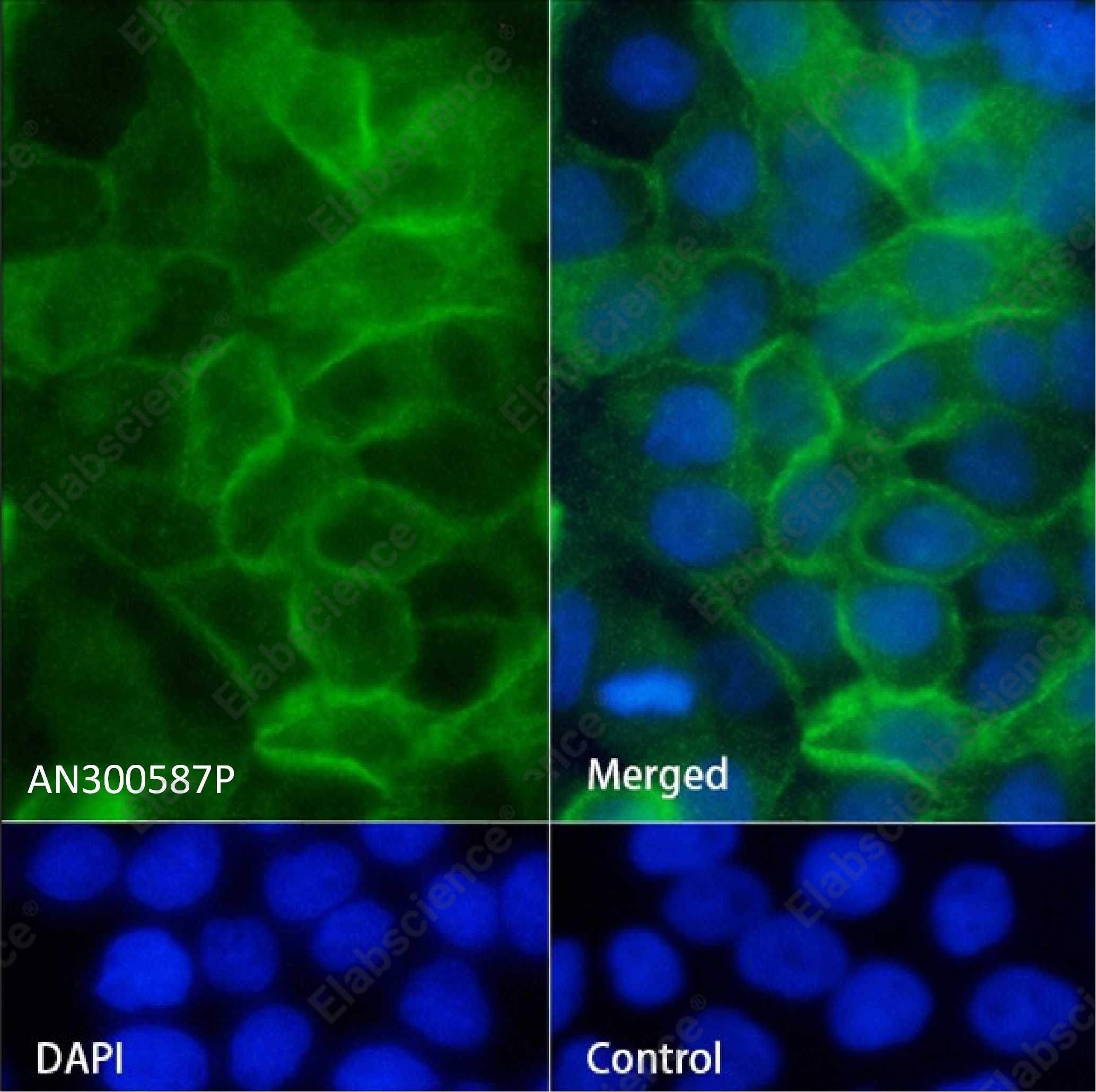 Recombinant BCAM/CD239 Monoclonal Antibody - 2