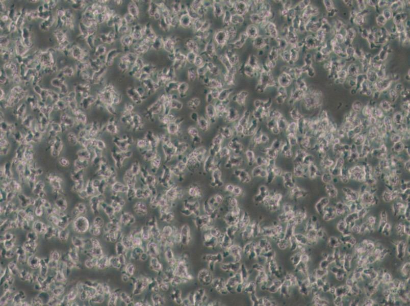 SU-DHL-1 Cell Complete Medium - small - 6