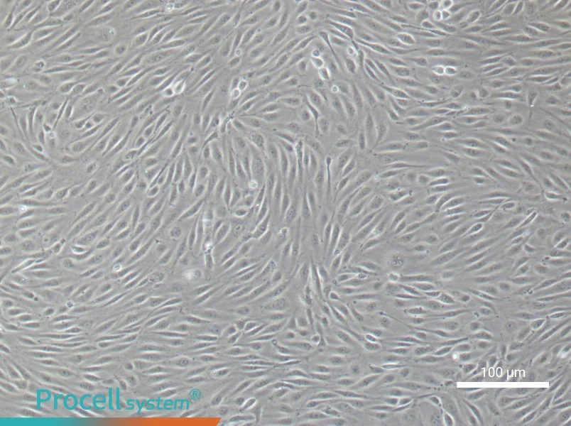Human Umbilical Vein Endothelial Cell Complete Medium - 3