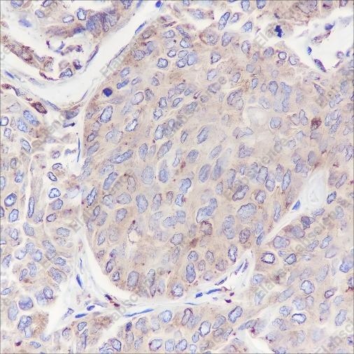 Recombinant GRP94 Monoclonal Antibody - 4