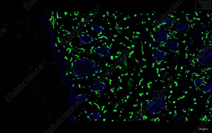 Recombinant Vimentin Monoclonal Antibody - 8