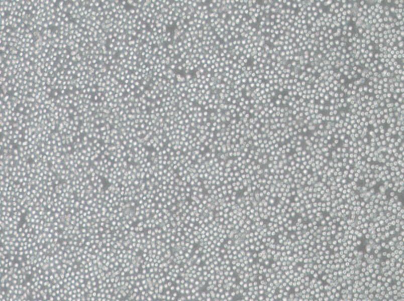 OCI-AML-3 Cell Complete Medium - 2