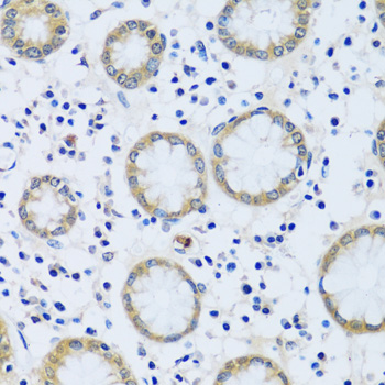 Immunohistochemistry of paraffin-embedded Human stomach using CABP7 Polyclonal Antibody at dilution of 1:100 (40x lens).