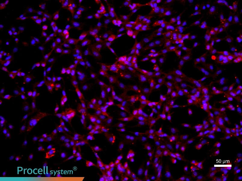 Human Articular Chondrocyte Complete Medium - 1