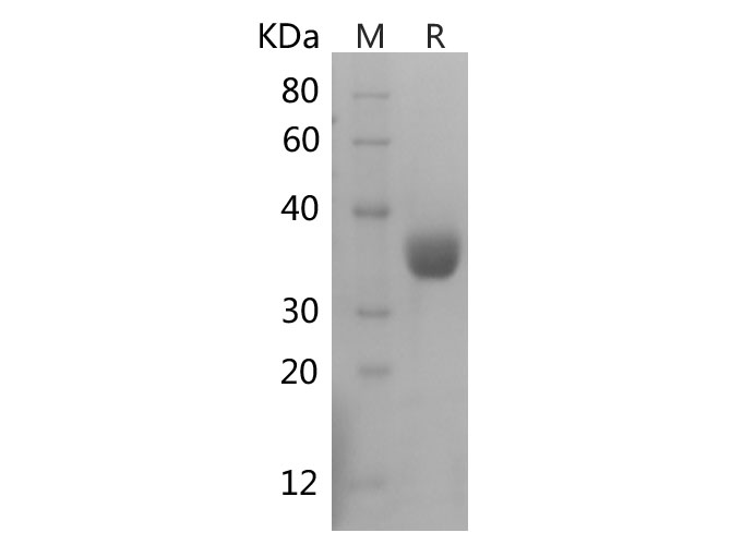 Recombinant Rat IL-6 Protein(Sumo Tag)-产品推荐-1