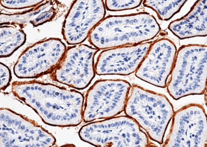 Recombinant CEACAM1/CD66a Monoclonal Antibody - small - 2