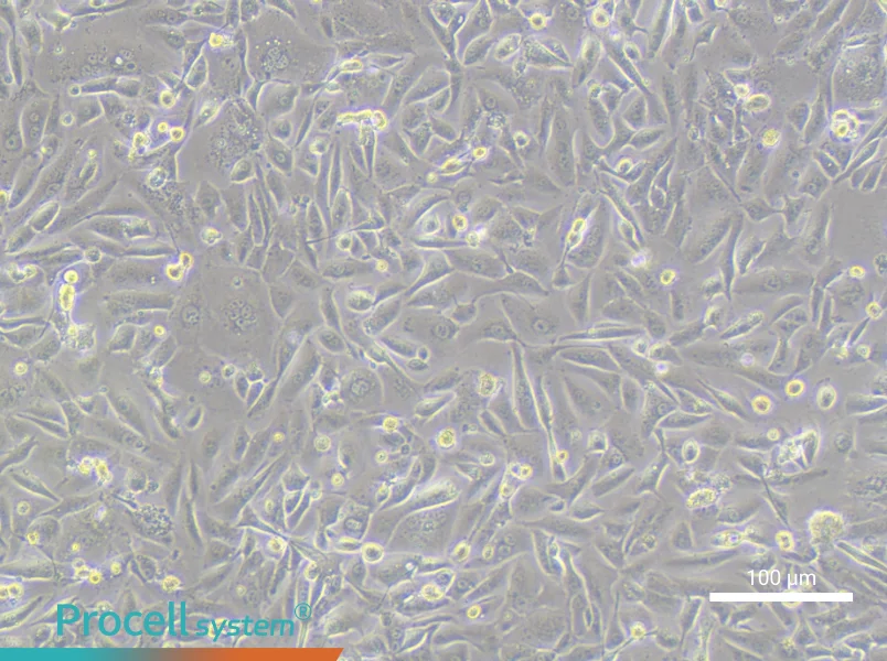 OV56 Cell Complete MediumOV56 Cell Complete Medium - 3