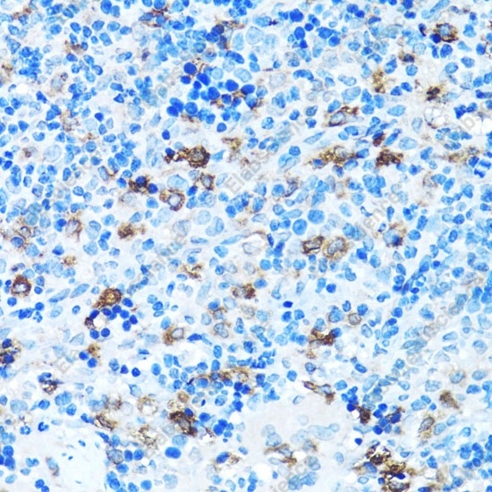 FGFR2 Polyclonal Antibody - 4