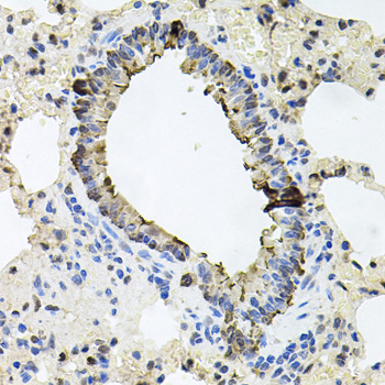 Immunohistochemistry of paraffin-embedded Rat lung using ERBB4 Polyclonal Antibody at dilution of  1:100 (40x lens).