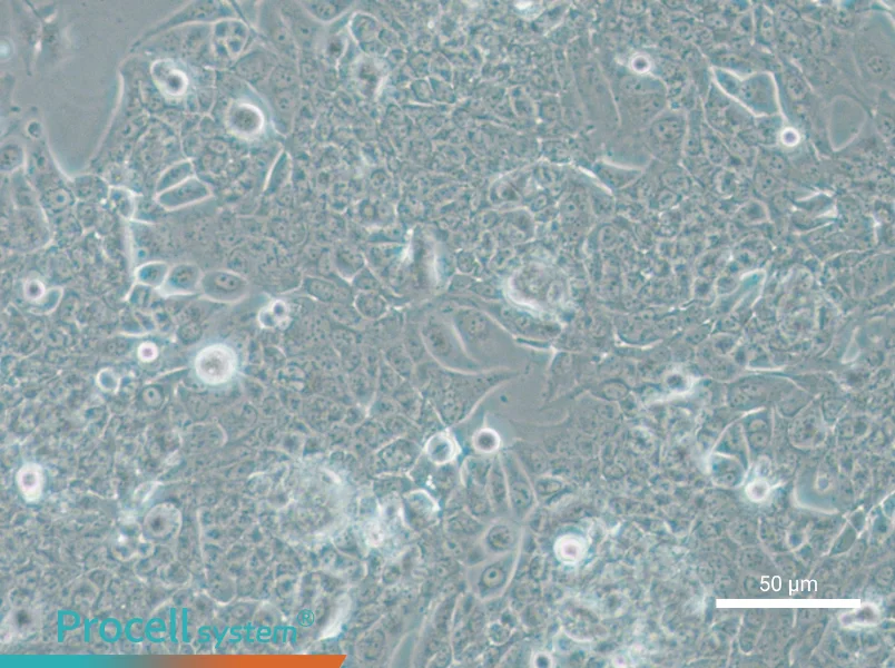 NCI-H1793 - 4