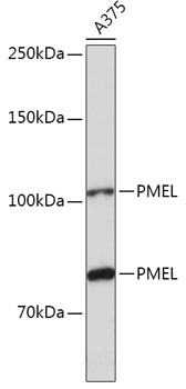 Western blot analysis of extracts of A375 cells using PMEL Polyclonal Antibody at 1:1000 dilution.