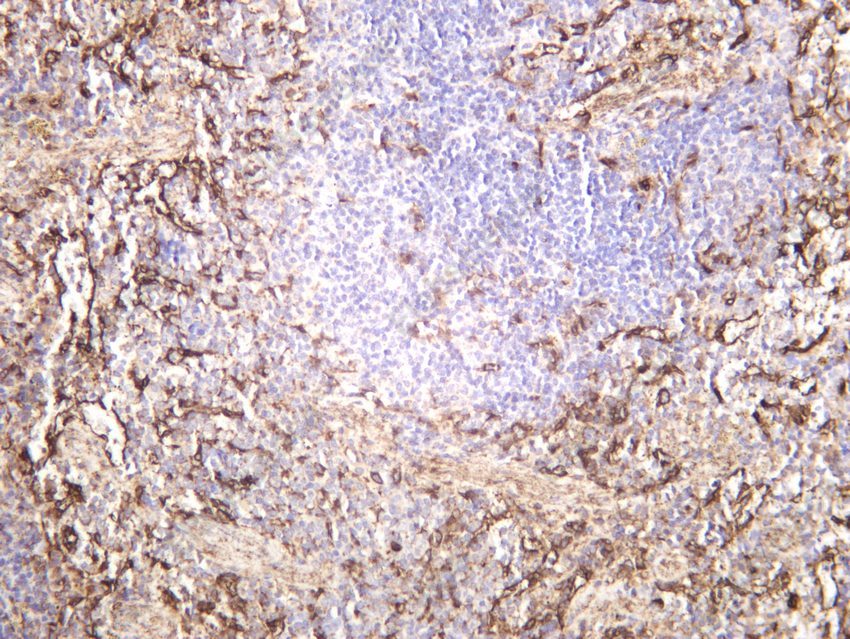 Recombinant ZO1 Monoclonal Antibody - 4