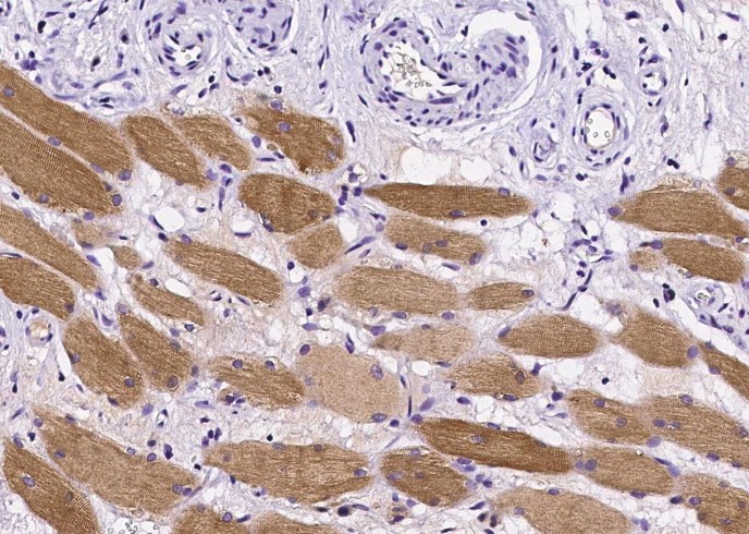 Recombinant RRM2B/P53R2 Monoclonal Antibody - small - 3