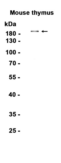 Recombinant DEC-205/LY75 Monoclonal Antibody - 1