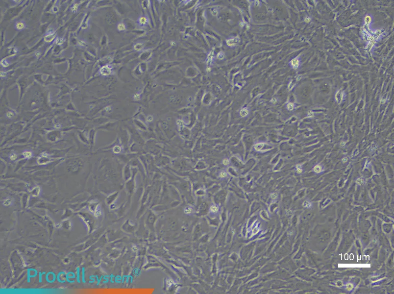 Rabbit Lung Fibroblast Complete Medium - 1