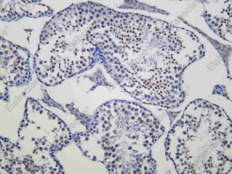 Recombinant TIF1α Monoclonal Antibody - 1