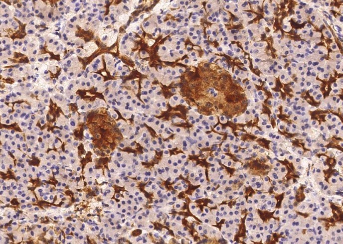 ENO2 Monoclonal Antibody - small - 2