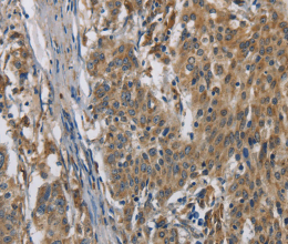 SIGMAR1 Polyclonal Antibody - 2