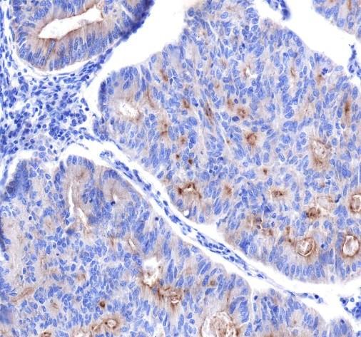Recombinant DR5 Monoclonal Antibody - small - 3