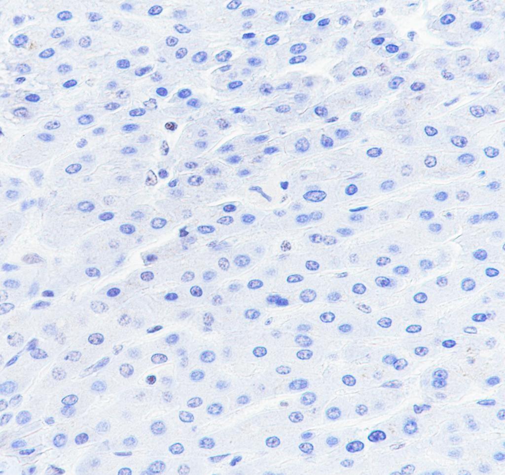 Recombinant DNAJC6 Monoclonal Antibody - small - 4