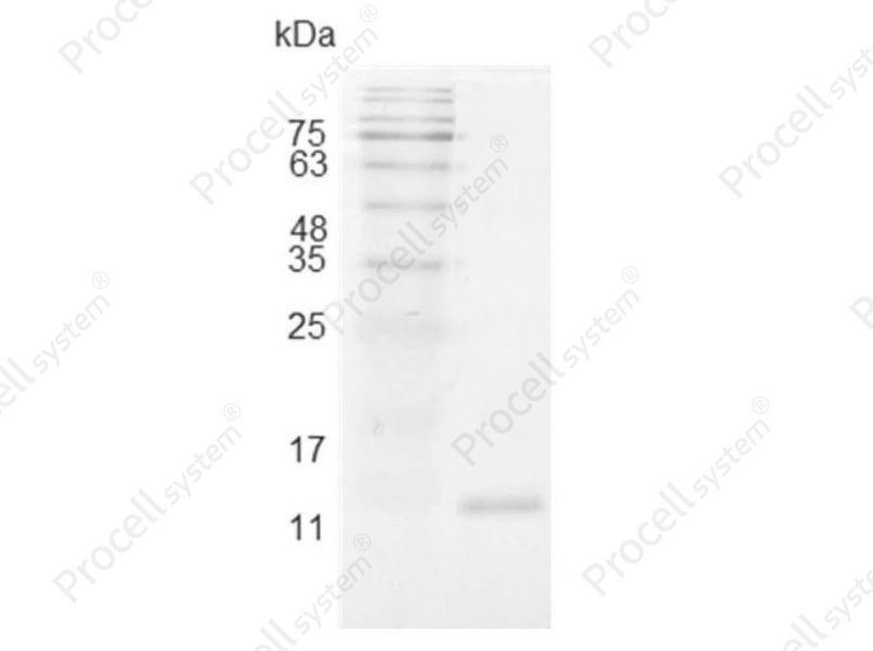 IL-2/TCGF/Aldesleukin, Swine, Recombinant