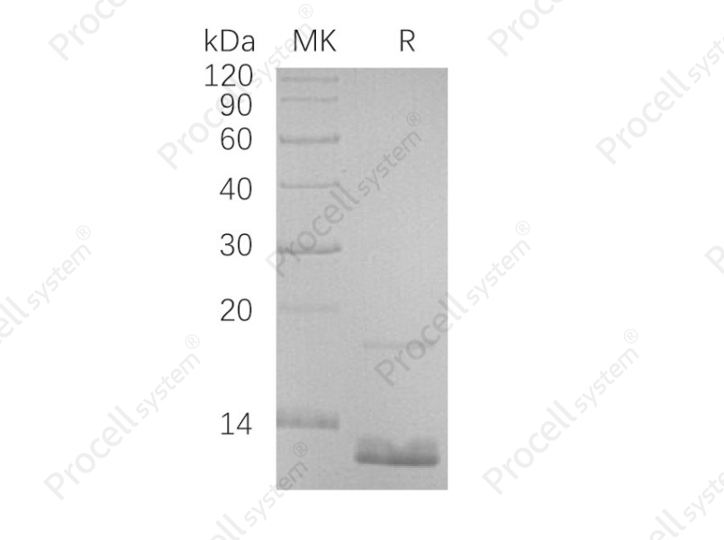 MIP-4/CCL18 (N-6His), Human, Recombinant
