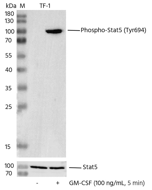 Recombinant Phospho-Stat5 (Tyr694) Monoclonal Antibody - small - 3