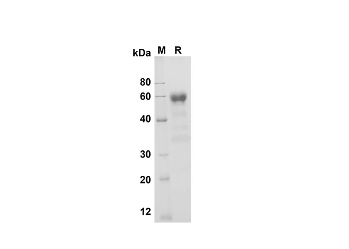 Recombinant Mouse TNFR1/TNFRSF1A Protein(His Tag)-产品推荐-1