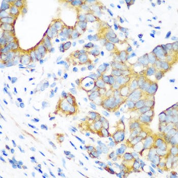 Immunohistochemistry of paraffin-embedded Human stomach using MTCO2 Polyclonal Antibody at dilution of 1:100 (40x lens).
