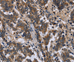 FRK Polyclonal Antibody - 2