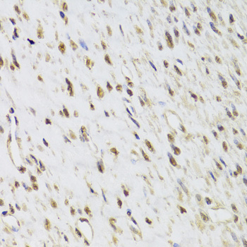 Immunohistochemistry of paraffin-embedded Human leiomyoma of uterus using SEPHS1 Polyclonal Antibody at dilution of 1:100 (40x lens).