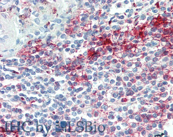 Immunohistochemistry of paraffin-embedded Spleen tissue using NLRP7 Polyclonal Antibody at dilution of 1:100(Elabscience Product Detected by Lifespan).