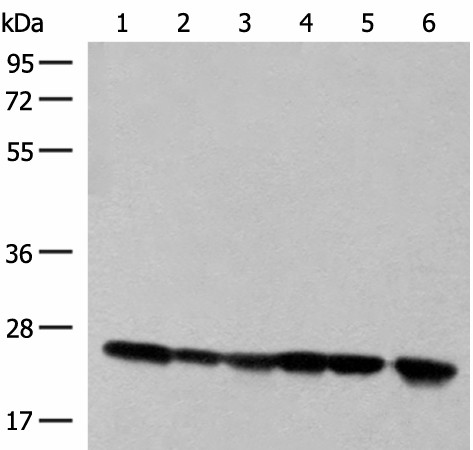 Western blot analysis of 293T cell and Human fetal liver tissue lysates  using DTYMK Polyclonal Antibody at dilution of 1:550