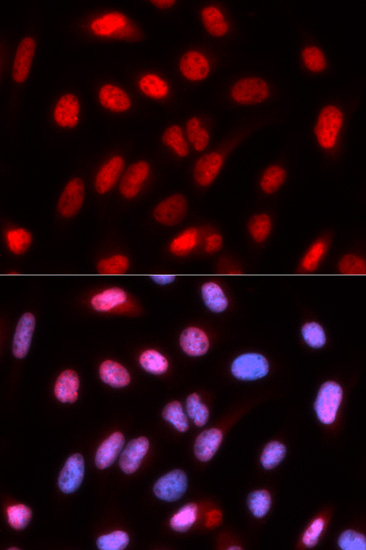Immunofluorescence analysis of U2OS cells using RFC4 Polyclonal antibody. Blue: DAPI for nuclear staining.