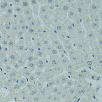 Immunohistochemistry of paraffin-embedded Rat liver using PRDM2 Polyclonal Antibody at dilution of 1:100 (40x lens).