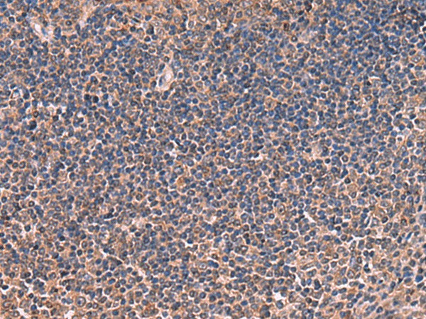 Immunohistochemistry of paraffin-embedded Human tonsil tissue  using ITIH4 Polyclonal Antibody at dilution of 1:30(?200)