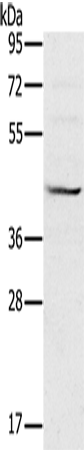 Western Blot analysis of Raji cell using MVK Polyclonal Antibody at dilution of 1:550