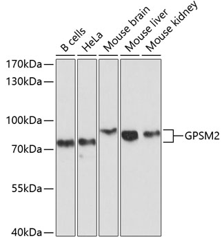 Western blot analysis of extracts of various cell lines using GPSM2 Polyclonal Antibody at 1:1000 dilution.